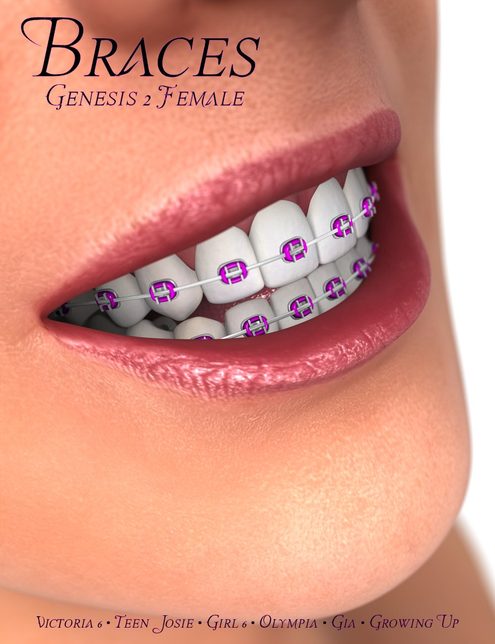 Braces for Genesis 2 Female(s) by: Mattymanx, 3D Models by Daz 3D