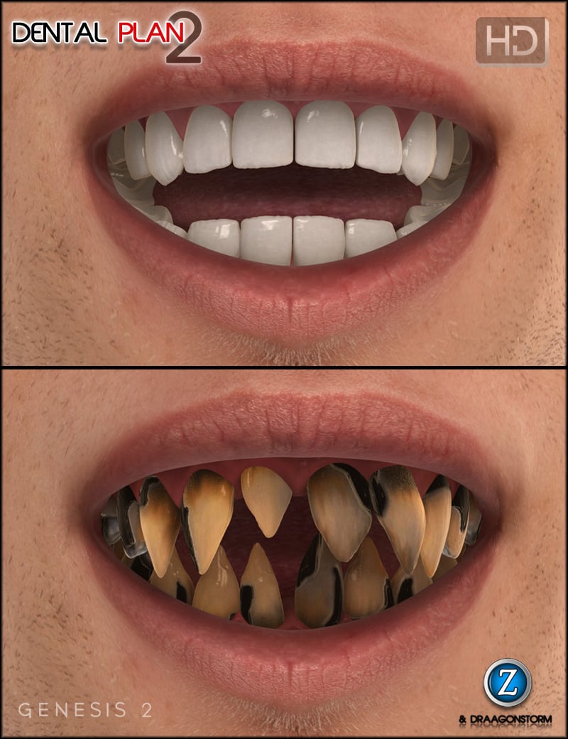 Dental Plan 2 HD for Genesis 2 Male(s) | Daz 3D