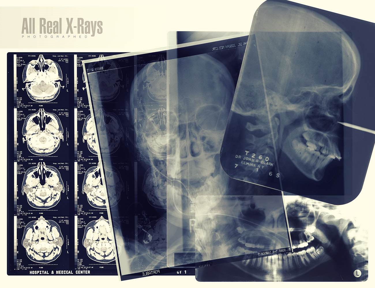 Ron's X-Rays by: deviney, 3D Models by Daz 3D