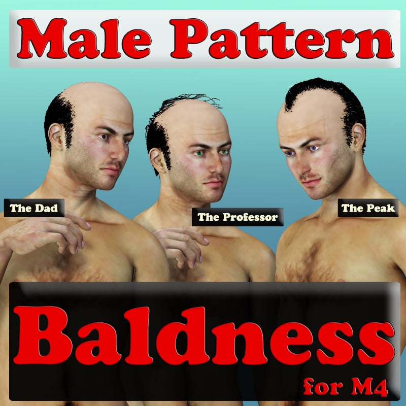 Male Pattern Baldness for M4 by: DarksealDigi-Mig, 3D Models by Daz 3D