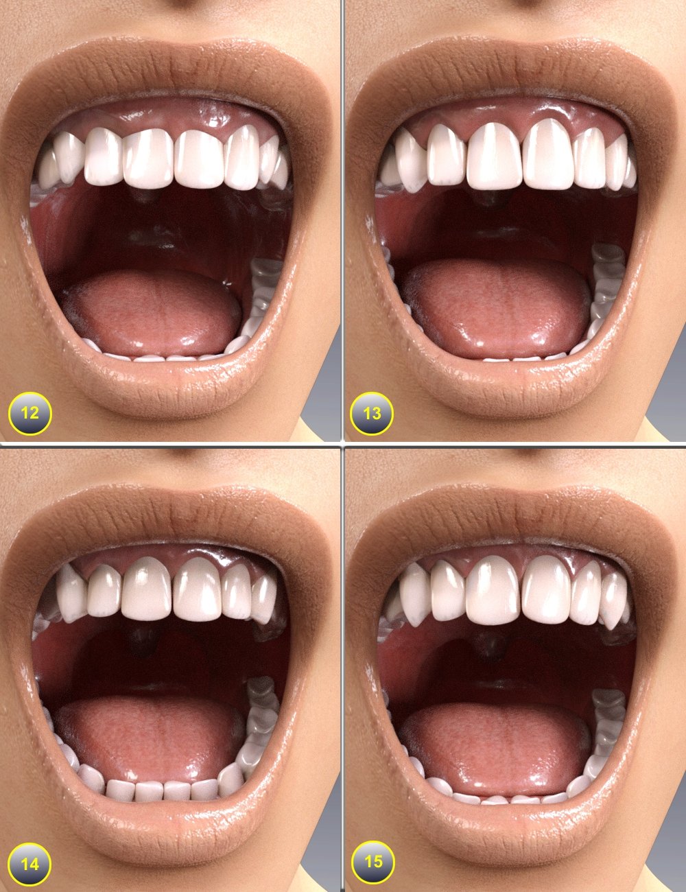 Alternative Jaws and Teeth for Genesis 8 Female(s) by: AlFan, 3D Models by Daz 3D
