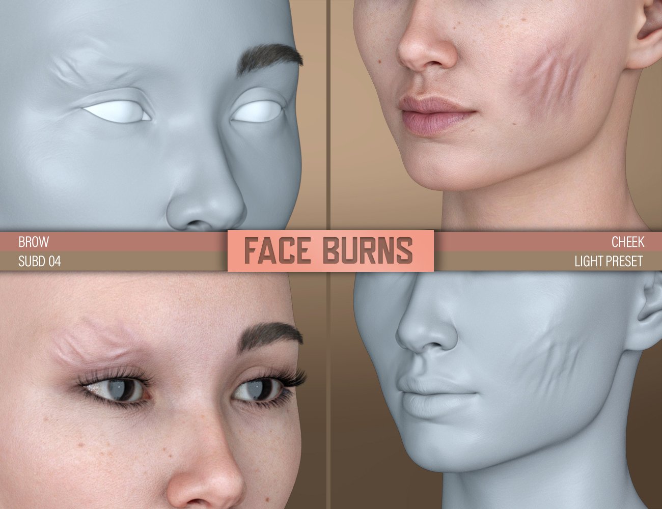 HD Face Burns for Genesis 8 Females HD Face Burns for Genesis 8 Females by: FenixPhoenixEsid, 3D Models by Daz 3D