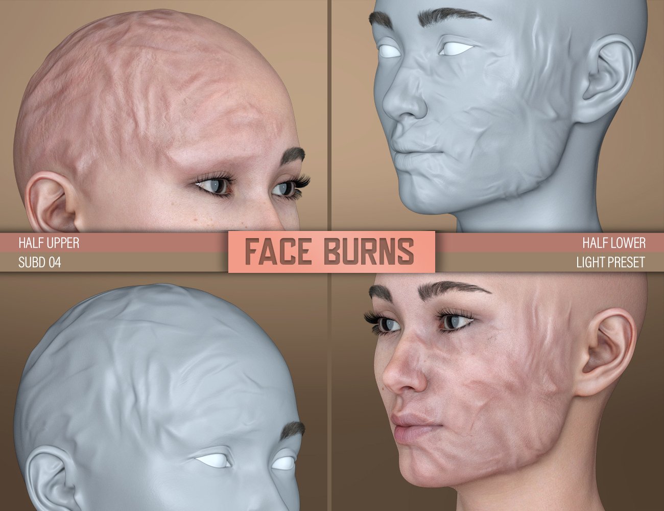 HD Face Burns for Genesis 8 Females HD Face Burns for Genesis 8 Females by: FenixPhoenixEsid, 3D Models by Daz 3D