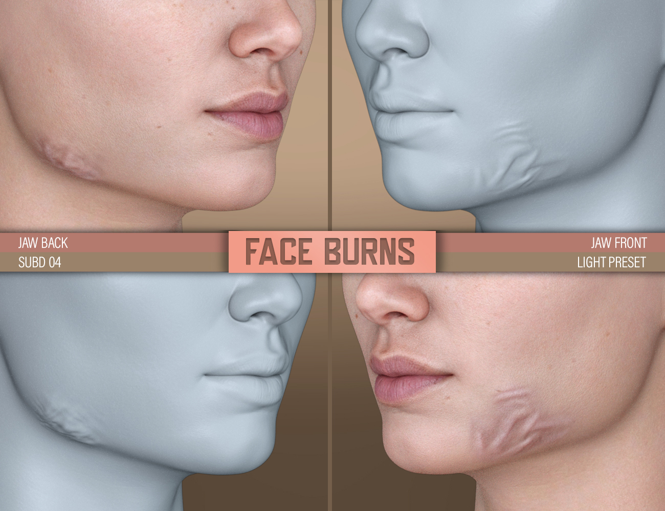 HD Face Burns for Genesis 8 Females by: FenixPhoenixEsid, 3D Models by Daz 3D