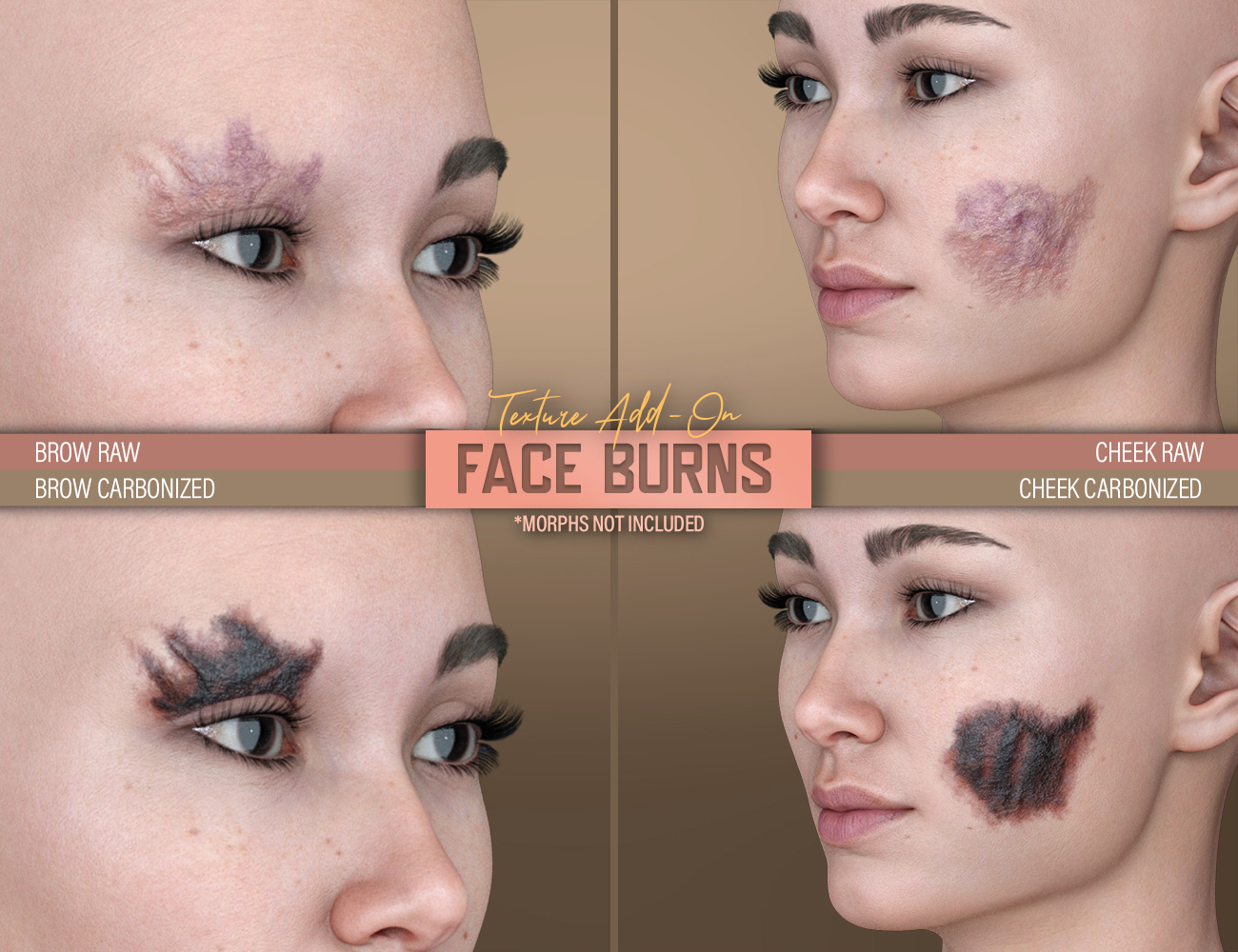 HD Face Burns AddOn for Genesis 8 Females by: FenixPhoenixEsid, 3D Models by Daz 3D