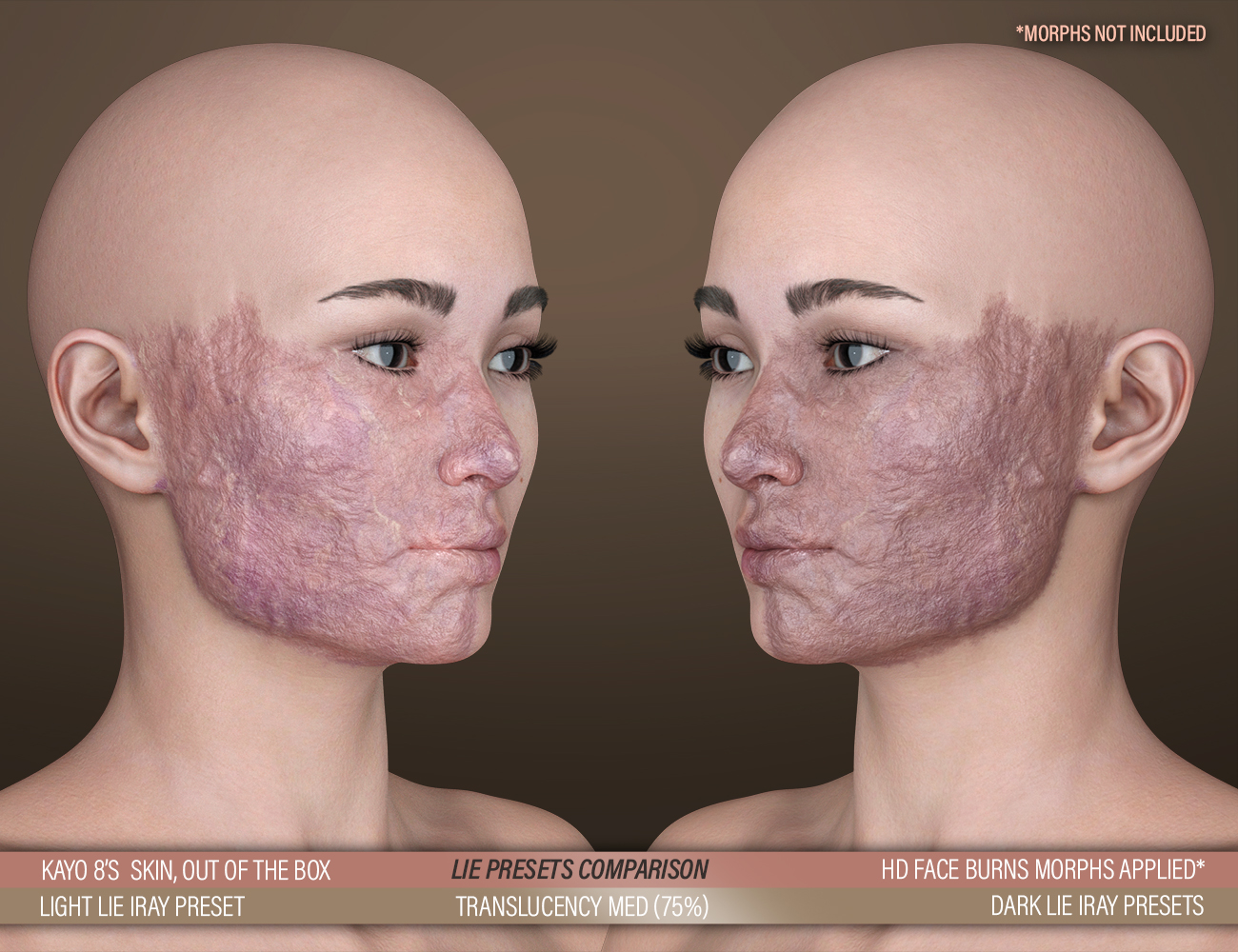 HD Face Burns AddOn for Genesis 8 Females HD Face Burns AddOn for Genesis 8 Females by: FenixPhoenixEsid, 3D Models by Daz 3D