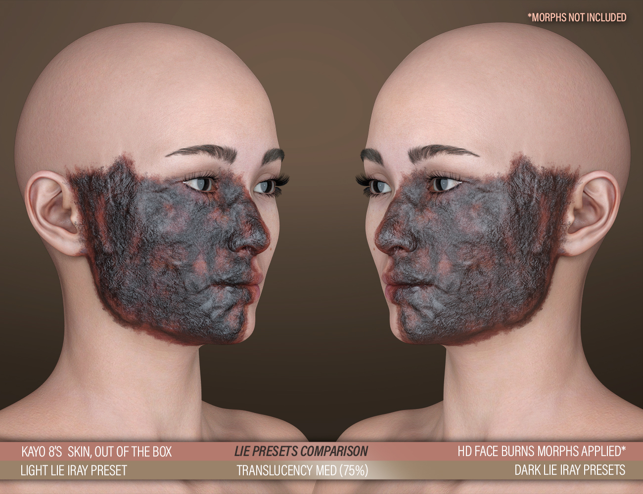 HD Face Burns AddOn for Genesis 8 Females by: FenixPhoenixEsid, 3D Models by Daz 3D