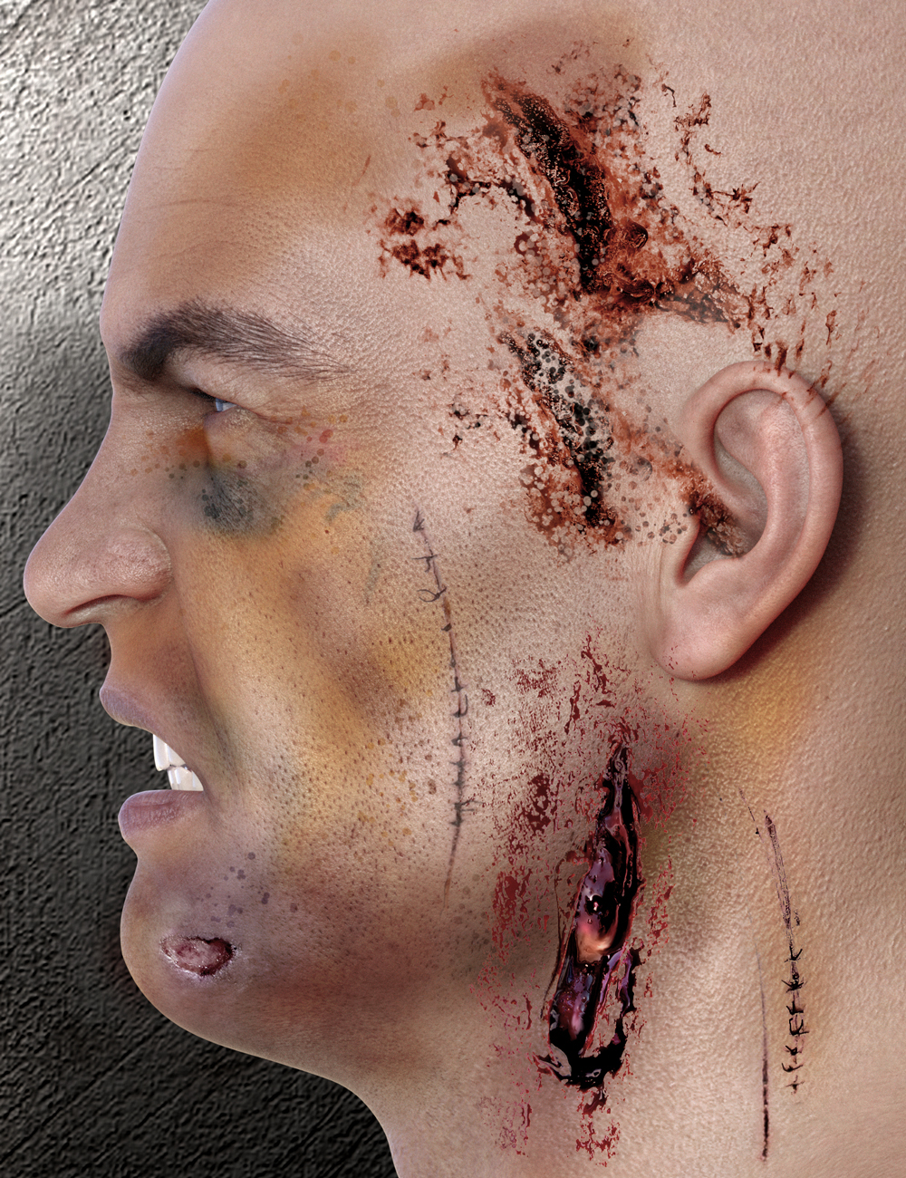 GNBD Scars & Stitches II by: Giko, 3D Models by Daz 3D