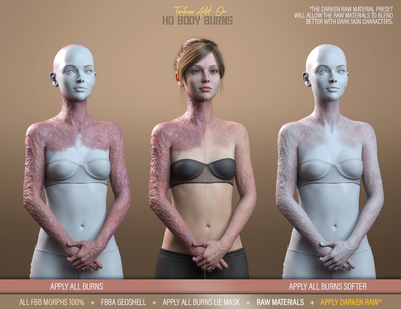 HD Body Burns Add-On for Genesis 8 and 8.1 Females HD Body Burns Add-On for Genesis 8 and 8.1 Females by: FenixPhoenixEsid, 3D Models by Daz 3D