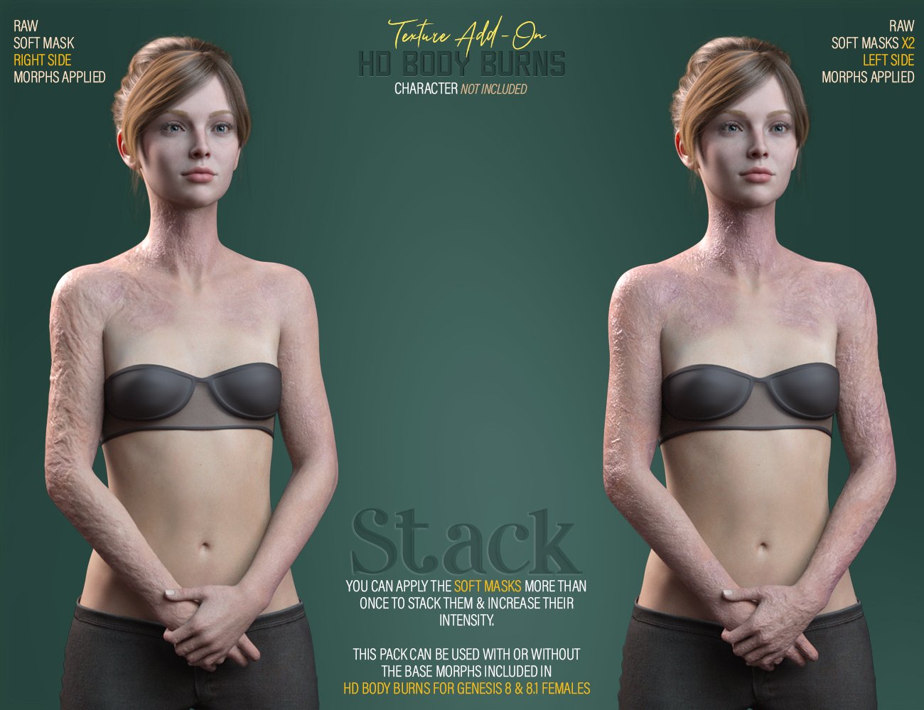 HD Body Burns Add-On for Genesis 8 and 8.1 Females HD Body Burns Add-On for Genesis 8 and 8.1 Females by: FenixPhoenixEsid, 3D Models by Daz 3D