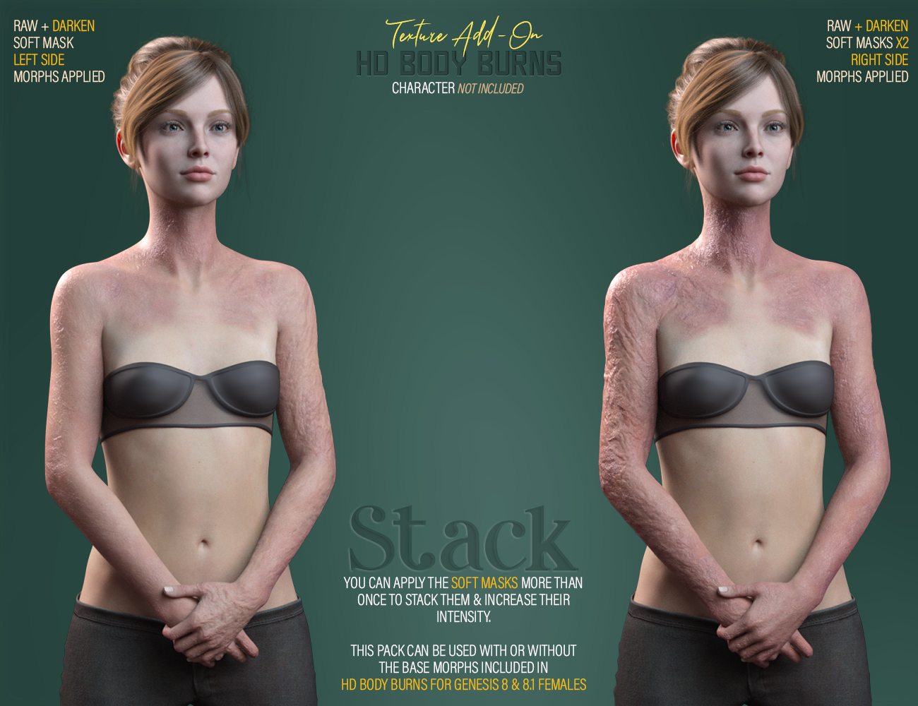 HD Body Burns Add-On for Genesis 8 and 8.1 Females by: FenixPhoenixEsid, 3D Models by Daz 3D