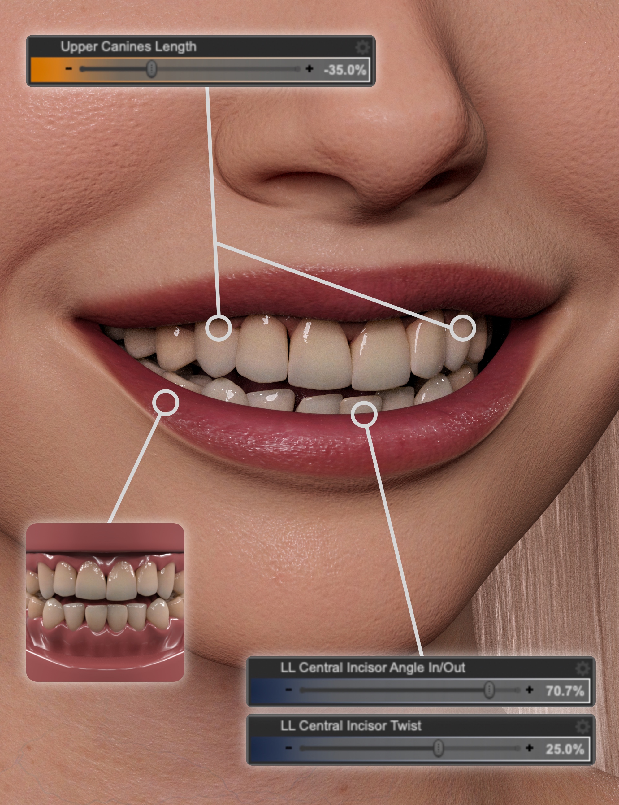 NG Build Your Own Smile for Genesis 9 - Dental Work by: NewGuy, 3D Models by Daz 3D