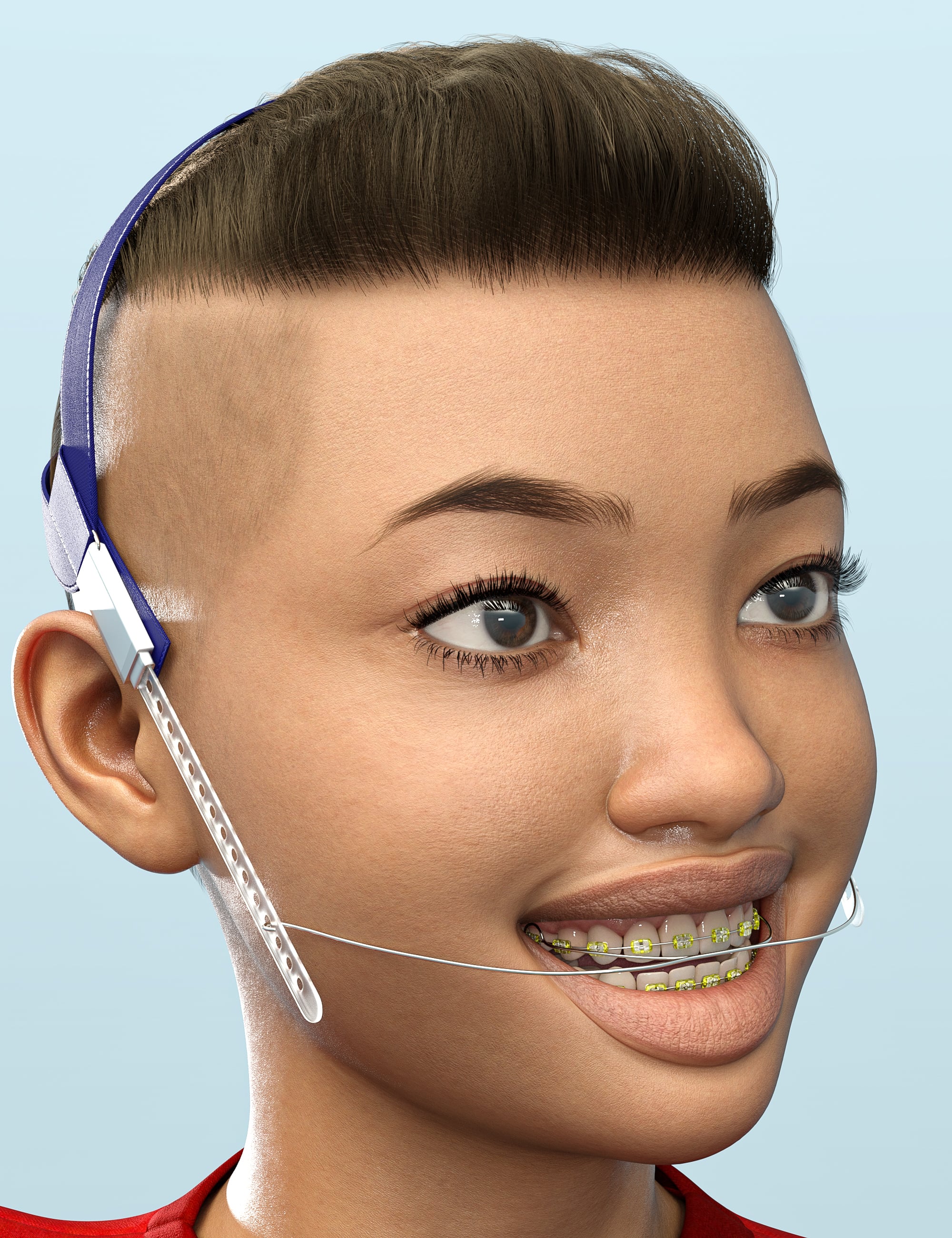 AH Orthodontic Braces For Genesis 9